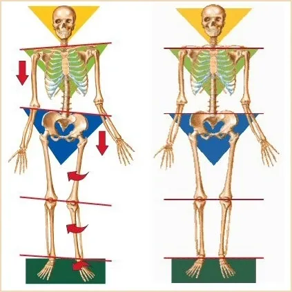 skeleton not-aligned vs. an aligned one